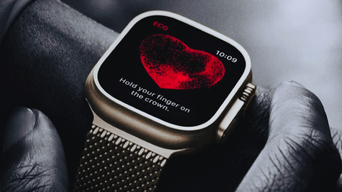 Why You Need an Apple Watch
