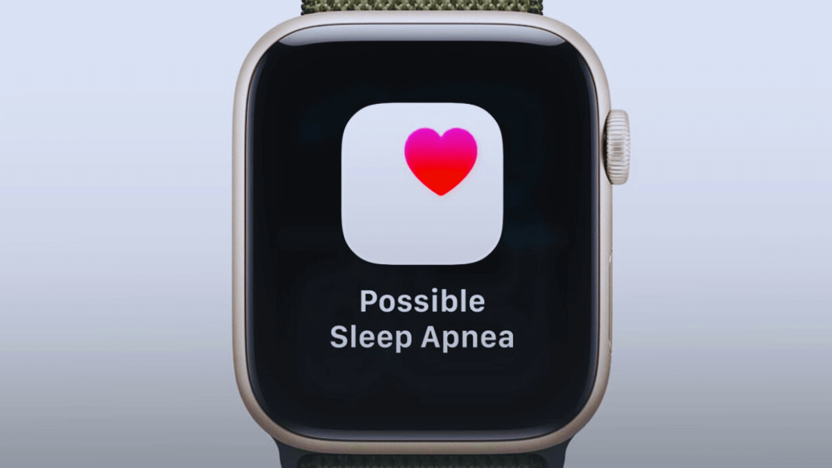 Why You Need an Apple Watch